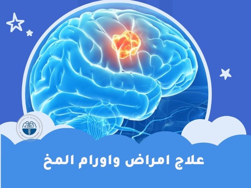 علاج امراض واورام المخ