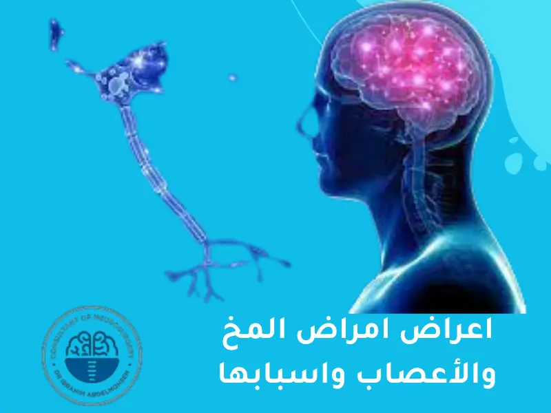 أهم اعراض امراض المخ والأعصاب واسبابها دكتور ابراهيم عبد المحسن